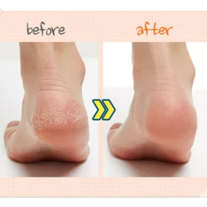 apieu-soft-foot-30-minute-peeling-socks-40ml-pic-2