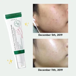 axis-y-dark-spot-correcting-glow-serum-50ml-pic-10