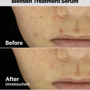 cosrx-the-aha-2-bha-2-blemish-treatment-50ml30-cotton-balls-pic-6