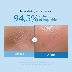 medicube-zero-pore-blackhead-deep-cleansing-oil-205ml-pic-4
