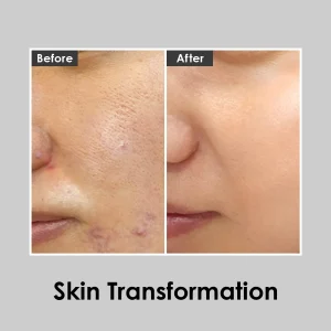medipeel-peptide-9-aqua-essence-emulsion-30ml-pic-4