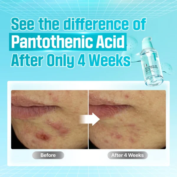 numbuzin-no1-pantothenic-b5-active-soothing-serum-50ml-pic-6