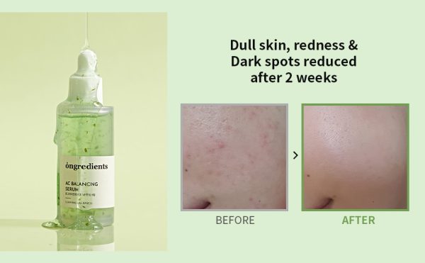 ongredients-ac-balancing-serum-50ml-pic-7