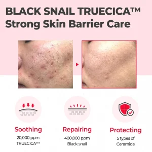 some-by-mi-snail-truecica-miracle-repair-cream-60g-pic-5