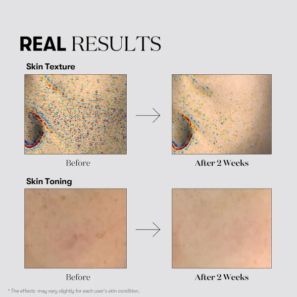 vt-cosmetics-tx-toning-toner-200ml-pic-3